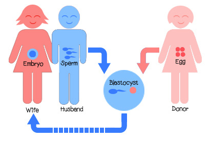 use egg donor scheme