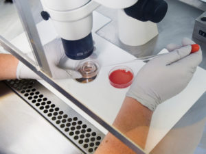 About the egg donation process